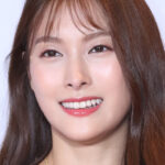 Park Gyuri de KARA contrainte de mettre en pause sa carrière suite à de sérieuses fractures au visage